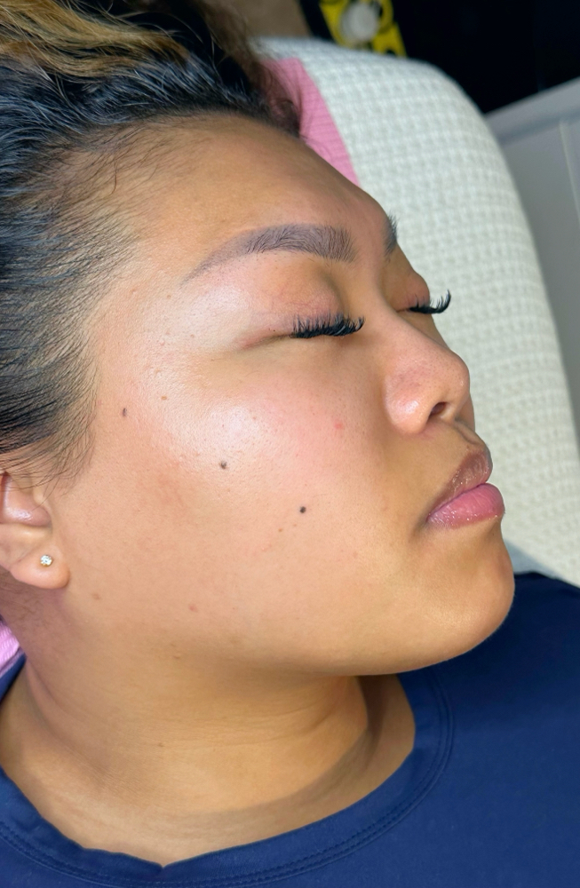 Dermaplaning (Returning)