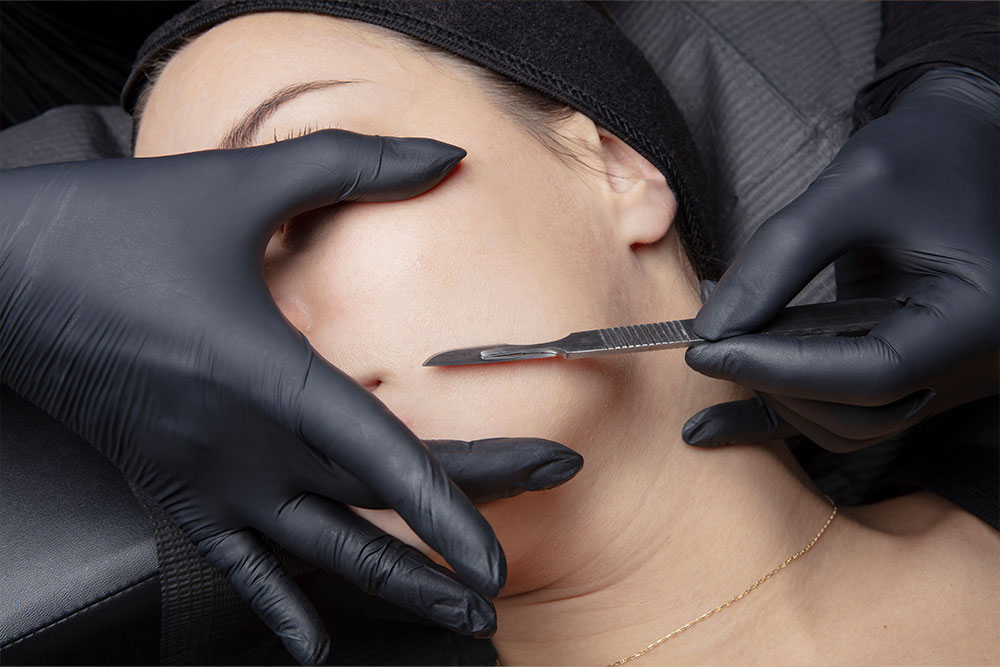 V LUXE Dermaplane Facial