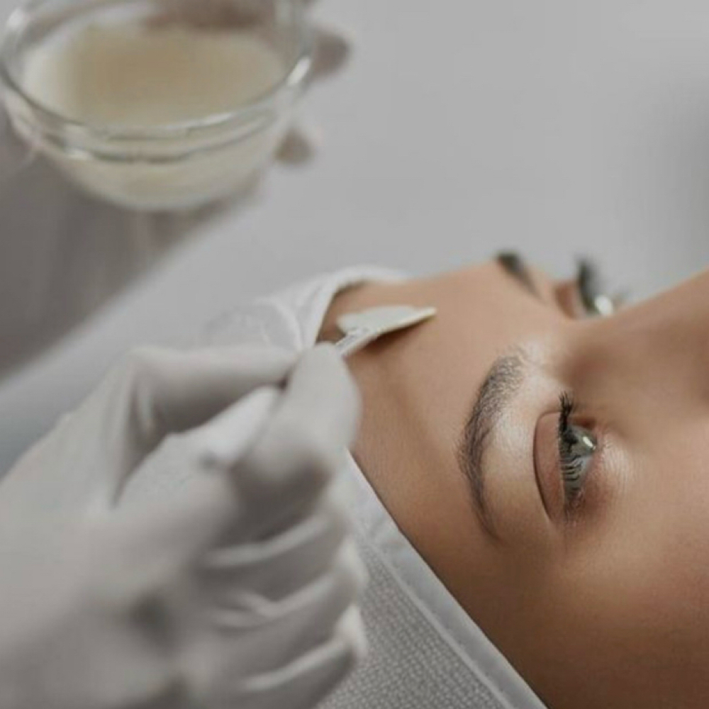 Chemical Peel Facial-Treatment at The Face Lounge by Blair in Columbia, MS