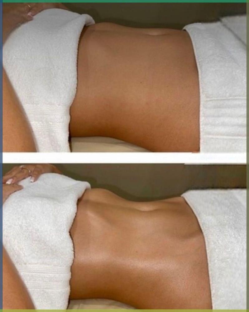 Spagirl Body Treatment Stomach at Dew Drop Aesthetics LLC in Fort Smith, AR