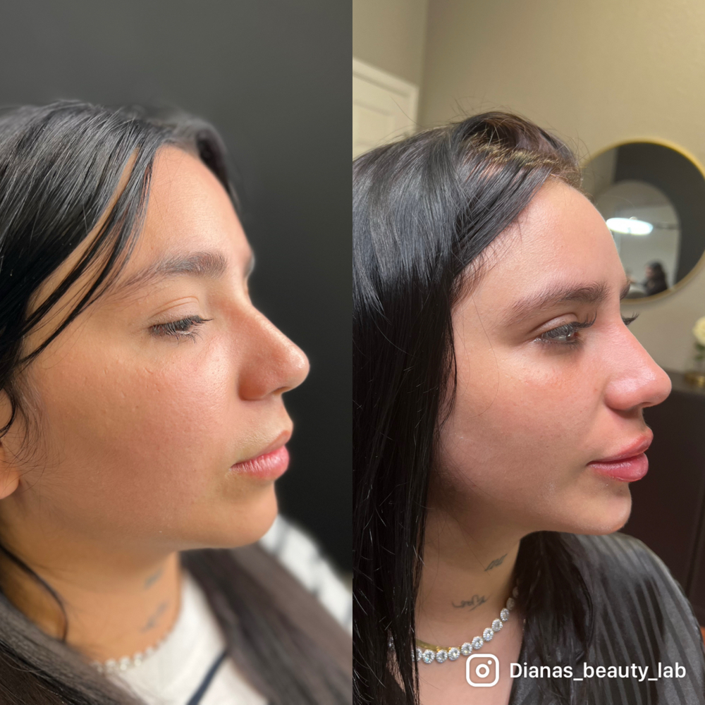 Full Facial Balence