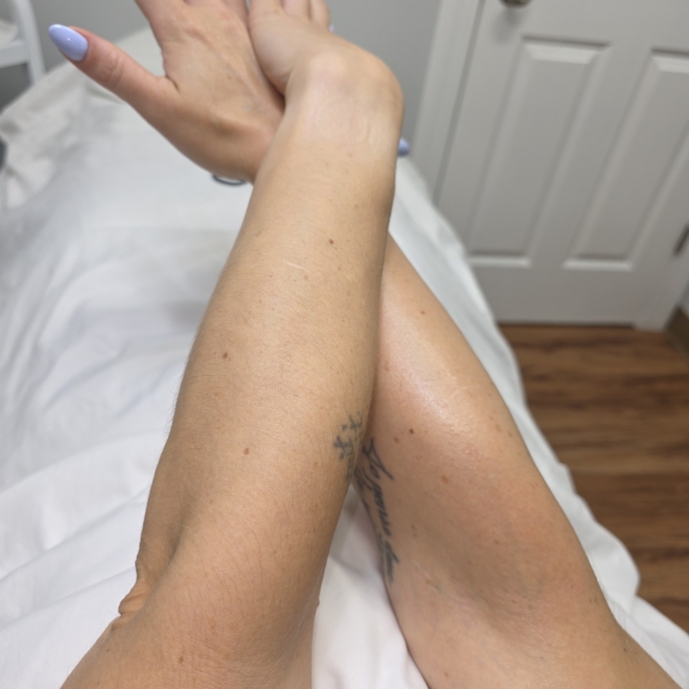 Waxing - Half Arms at Celtic Spa Laser Services in Attleboro, MA