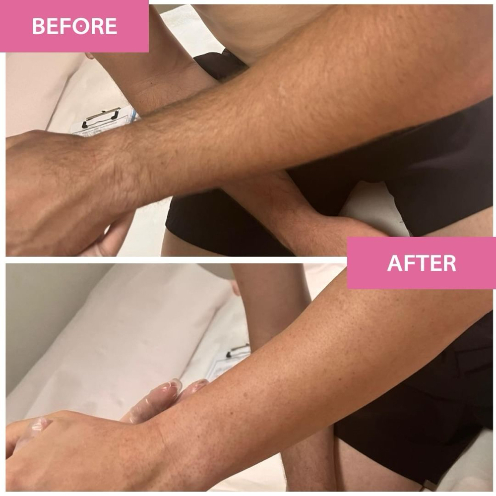 Full Arm at Mulberry By Her in Las Vegas, NV