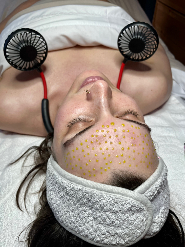 BioRePeel Facial Package