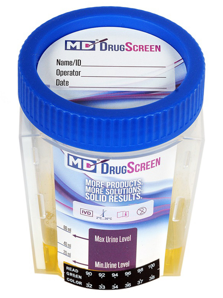 UA drug test