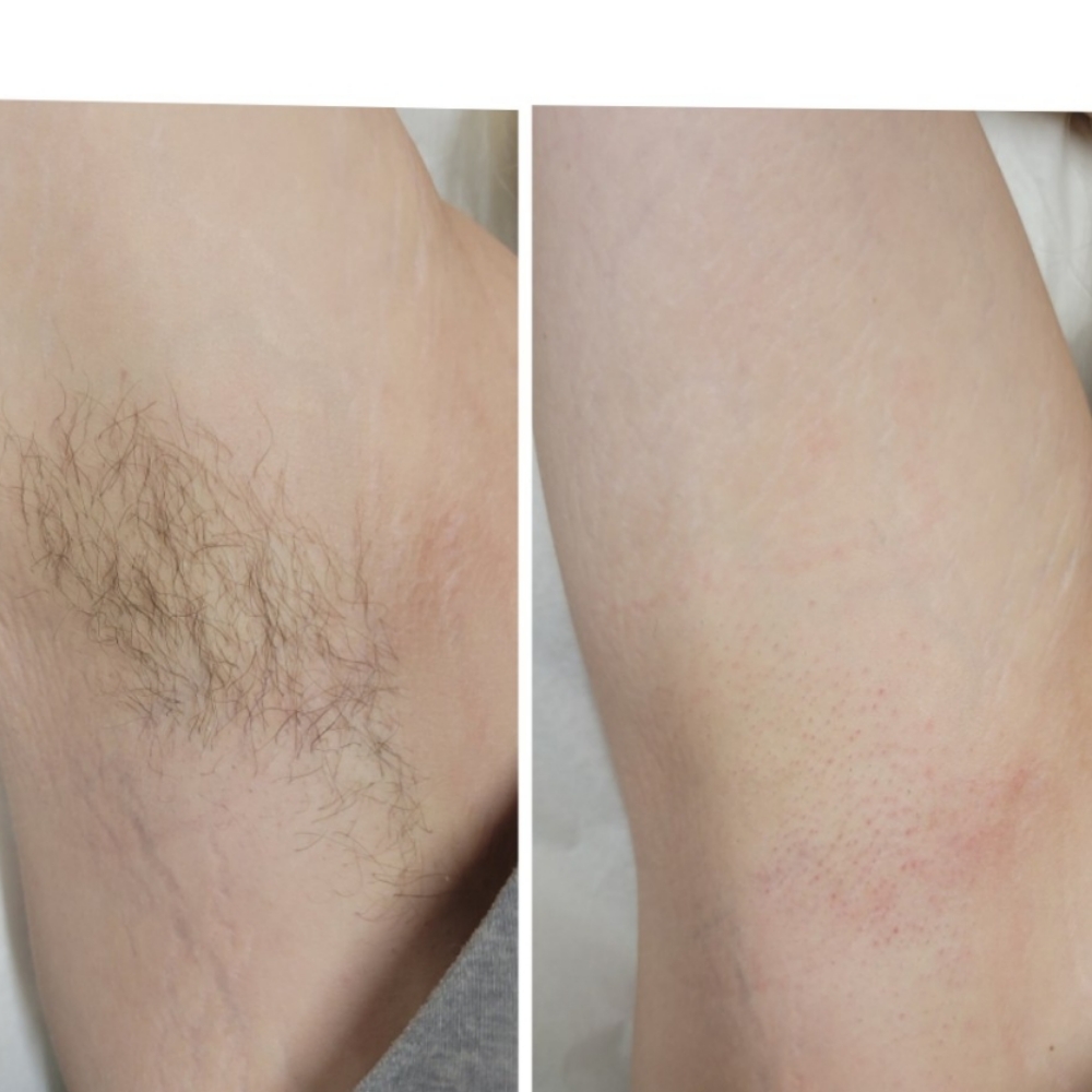 Armpit Wax at Bare or Beat in Fayetteville, NC