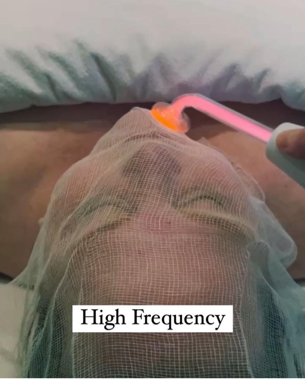 HIGH FREQUENCY