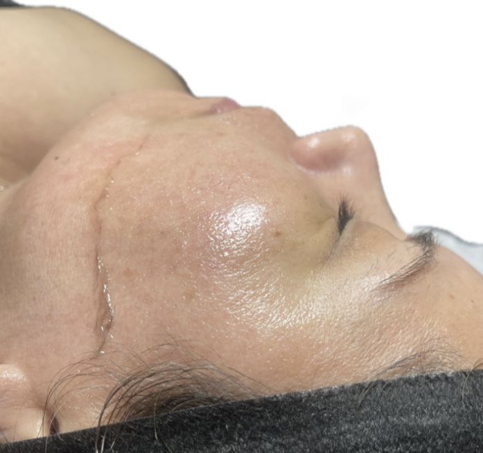 THE SIGNATURE FACIAL (ABN)