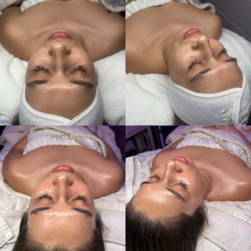 Customized/ Deep Cleanse Facial