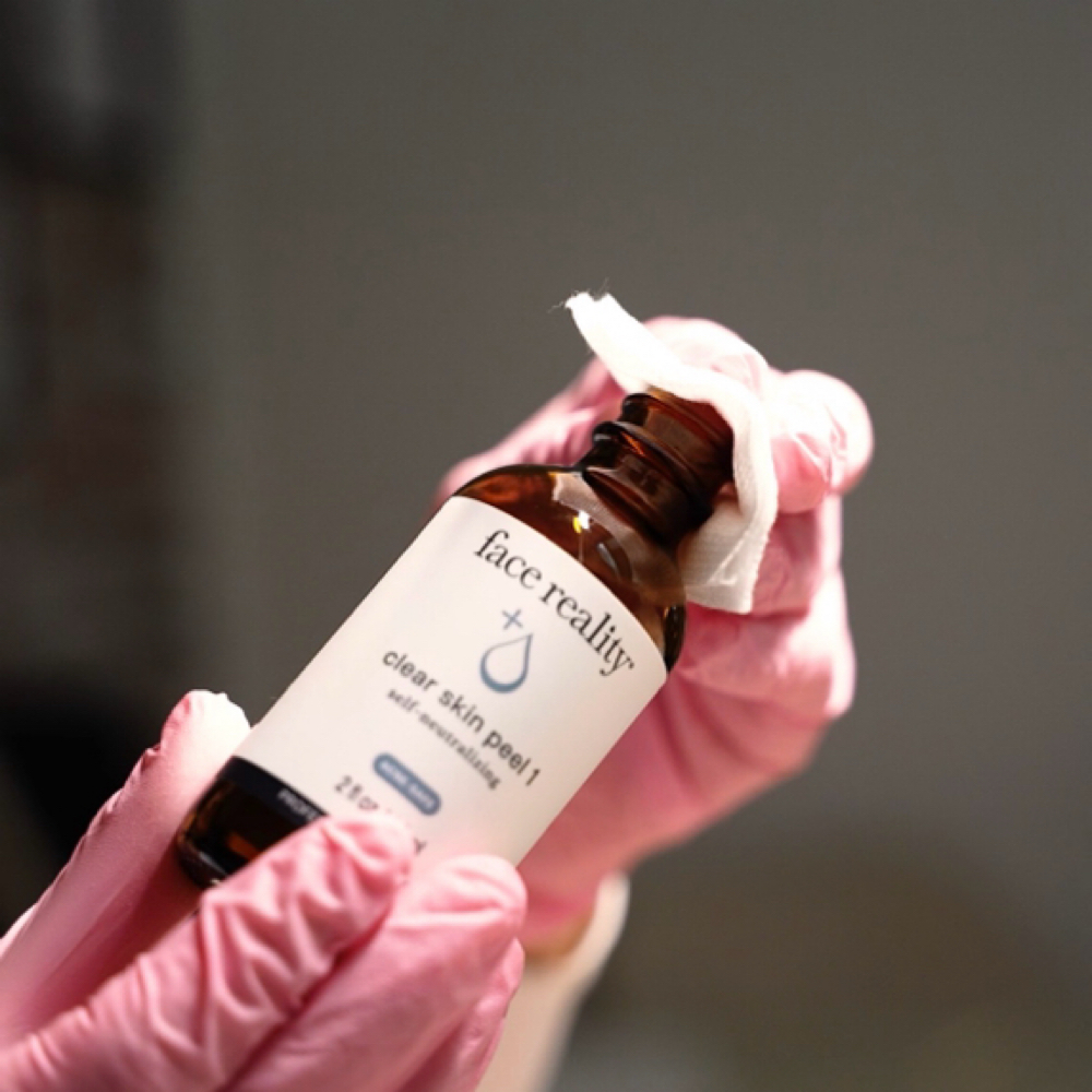 Biweekly Acne Treatment at Bare Beauty Esthetics in Sayville, NY