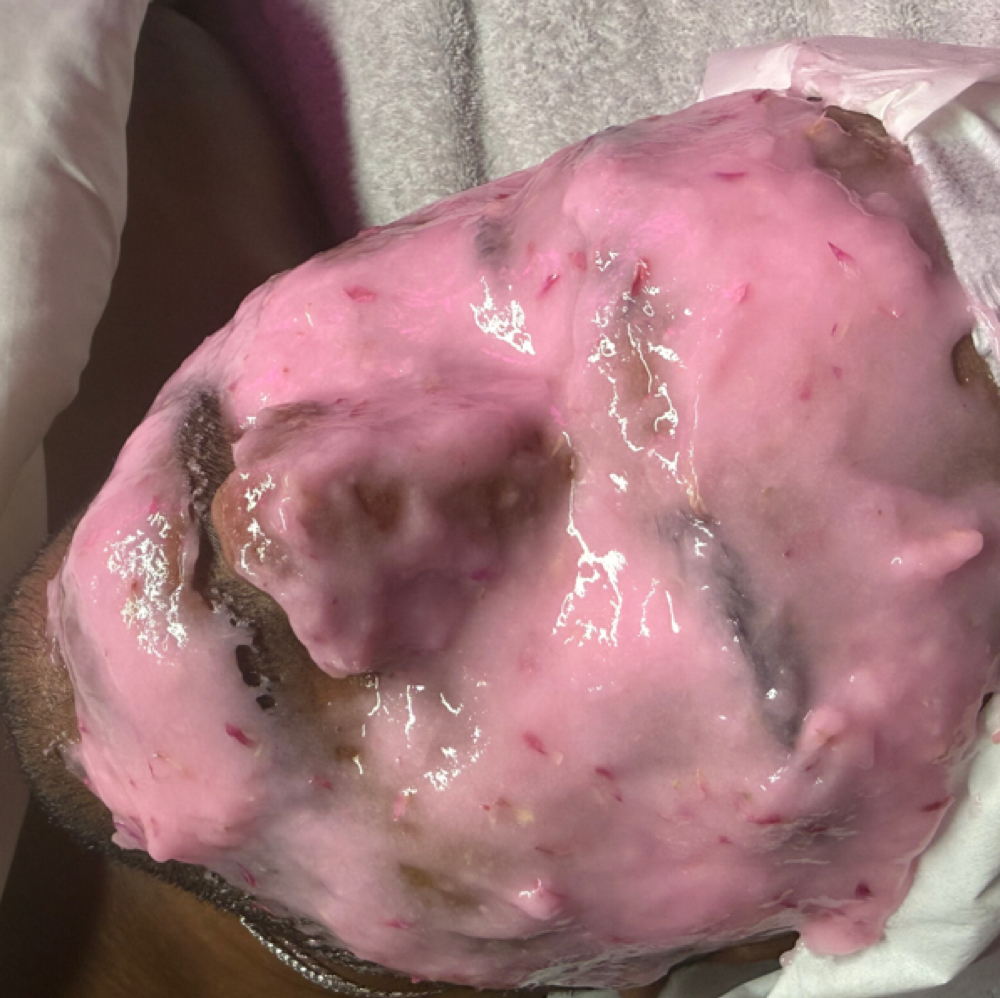 Jelly Mask at Glow with Pho in Wilmington, MA