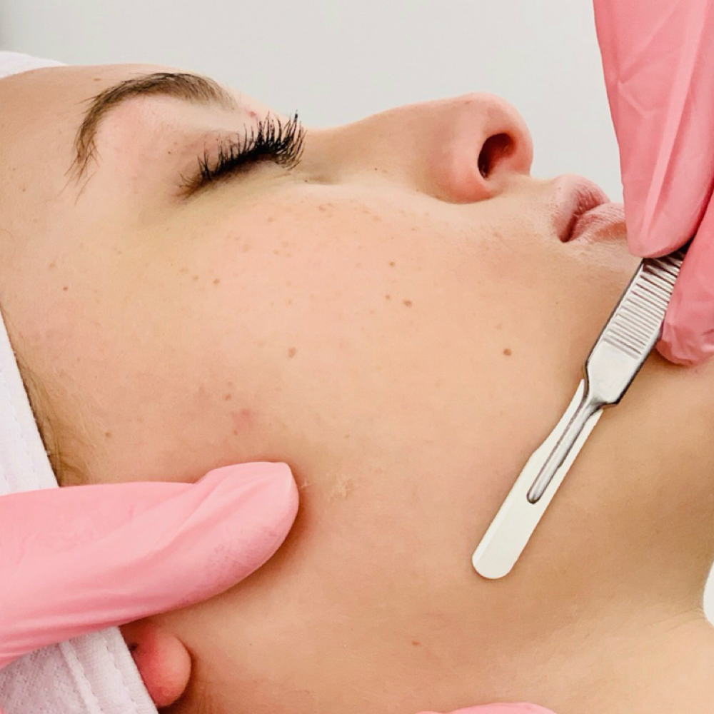 Dermaplaning at Glamour By B in Minotola, NJ