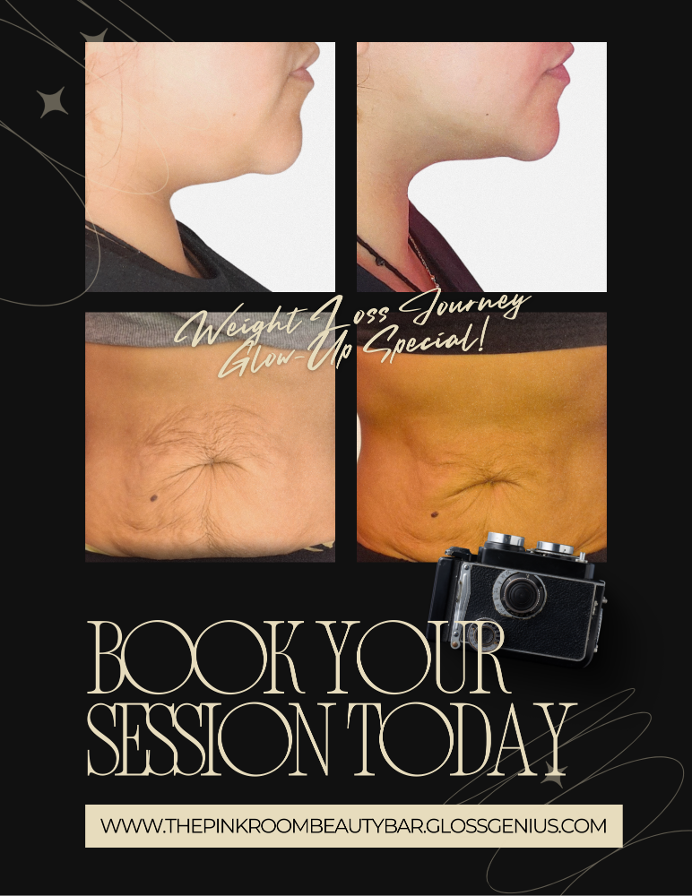 Skin Tightening 1 Session