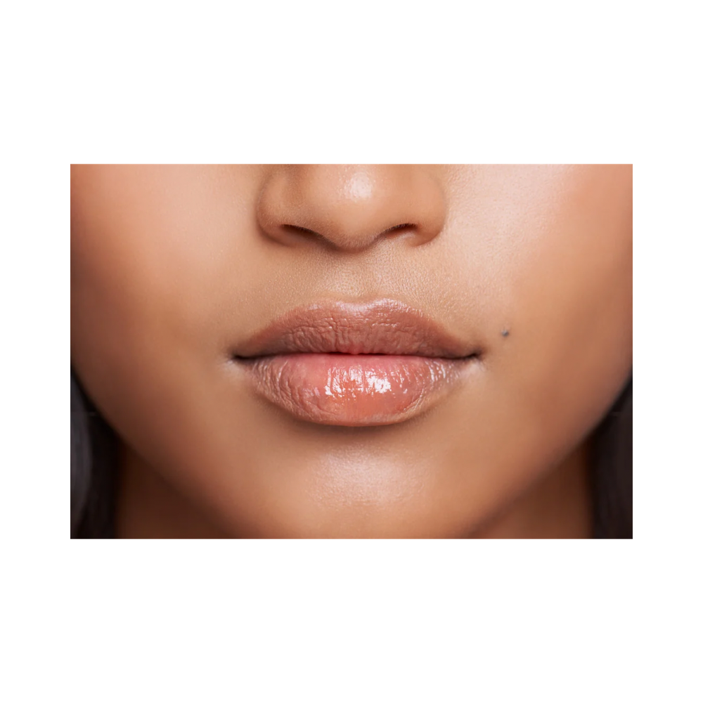 Laser Removal- Upper Lip 6 Sessions
