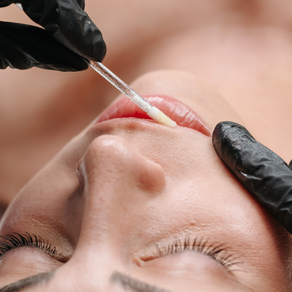 Lip Enhancement *add-on only* at The Skin Bar LLC in Bemidji, MN