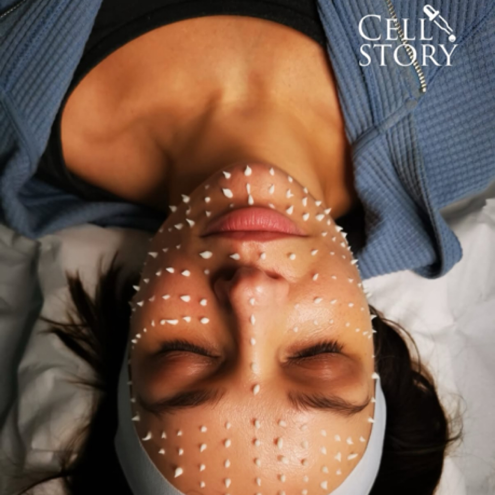 Cell Story Liquid Microneedling at The Glöw Method in Tucson, AZ