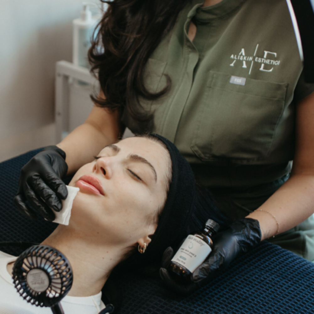 Acne Bootcamp Consult & Treatment at Aliskin Esthetics in Las Vegas, NV