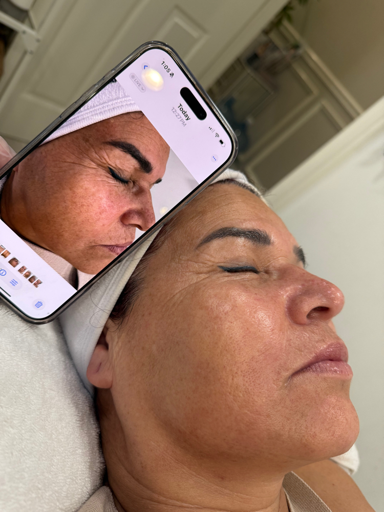 ✨ Anti-Aging Peeling ✨