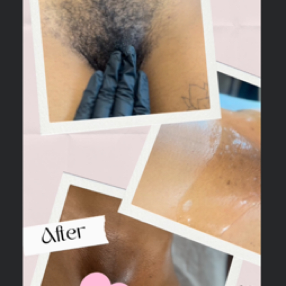 Brazilian Wax | Houston at Bare RX + Wellness | Full Body Waxing in Midtown Houston in Houston, TX