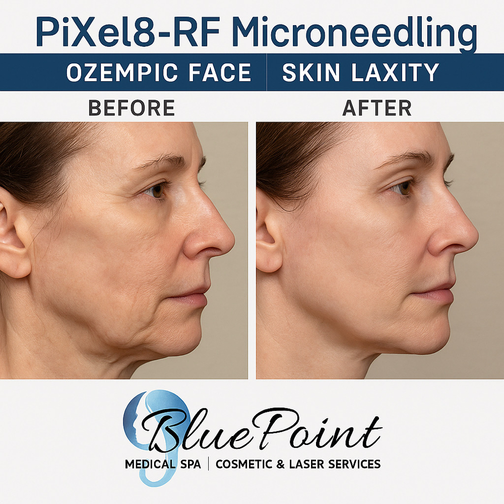 Laser/Med Spa Service Request