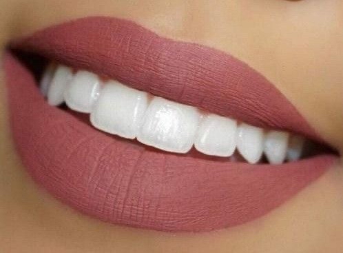 Teeth Whitening - Regular*