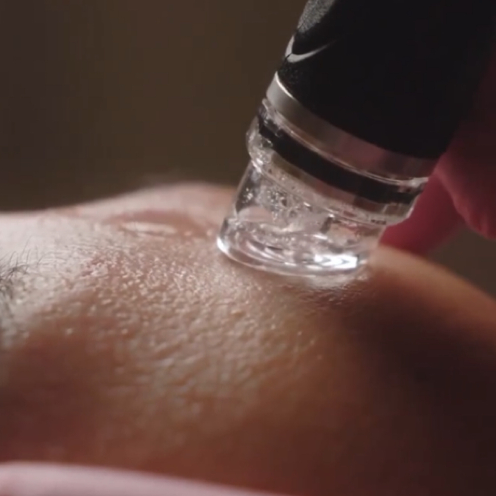 Signature Hydrafacial at Northern Roots Salon and Spa in Norfolk, NY