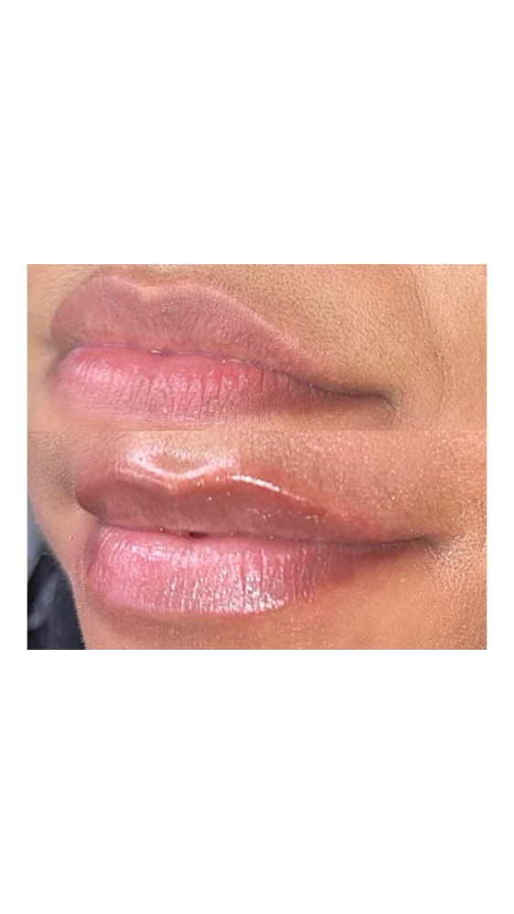 HYALURON LIP STEP 01 [UNISEX]™