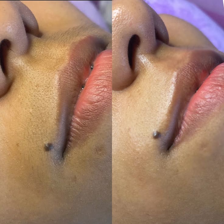 Upper Lip Wax