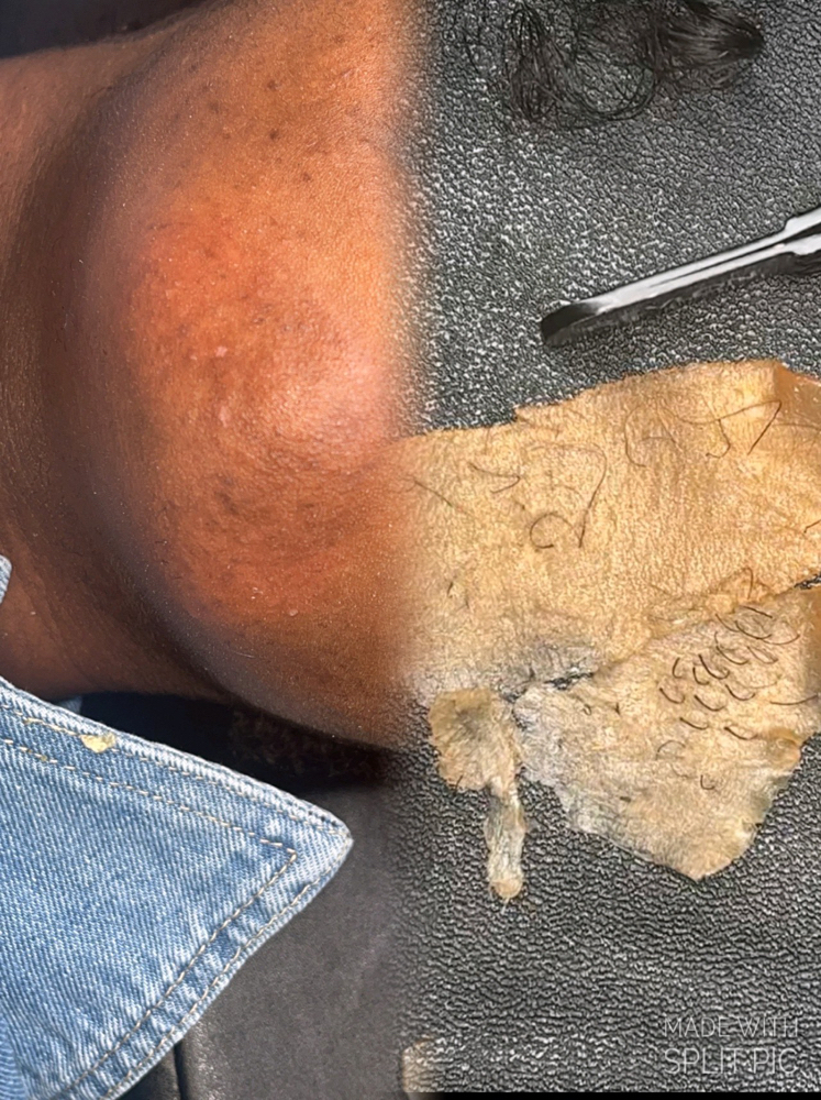 Chin Wax