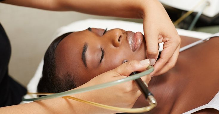Microdermabrasion Facial