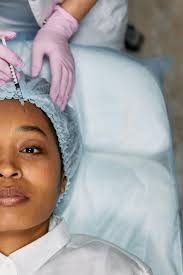 Botox (Neuromodulators)
