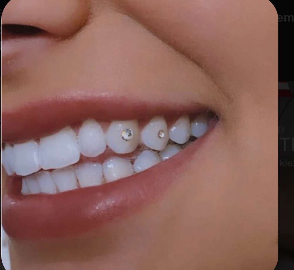 Two Tooth Gems