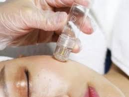 Jet- Face Epidermal Stamping