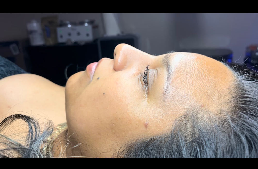 Dermaplane Glow ✨