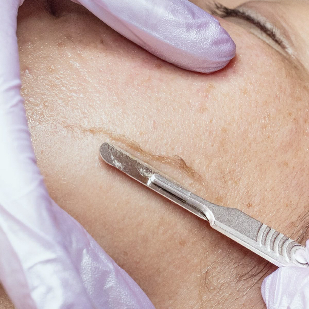 Express Dermaplaning Facial