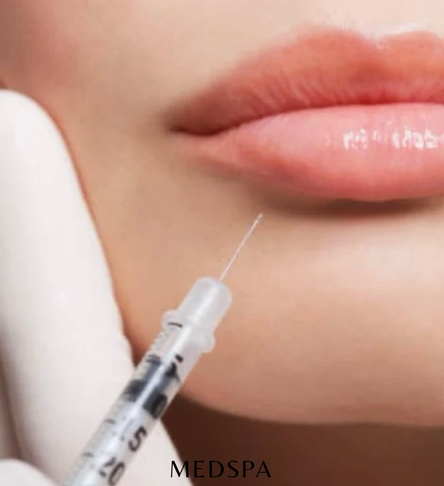 Lip Filler -1/2 Syringe