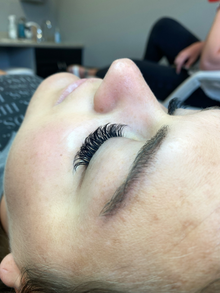 Microdermabrasion Facial