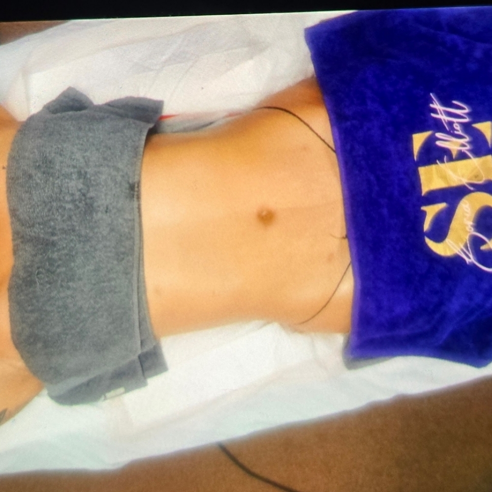 (30) Post OP Care Brazilian Lymphat