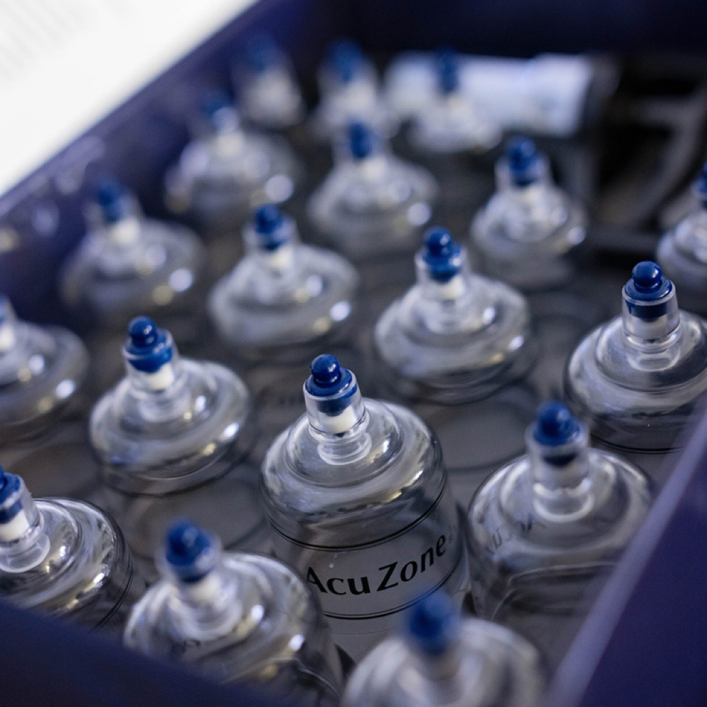 Cupping at Optimum Massage Therapy in Johnstown, OH