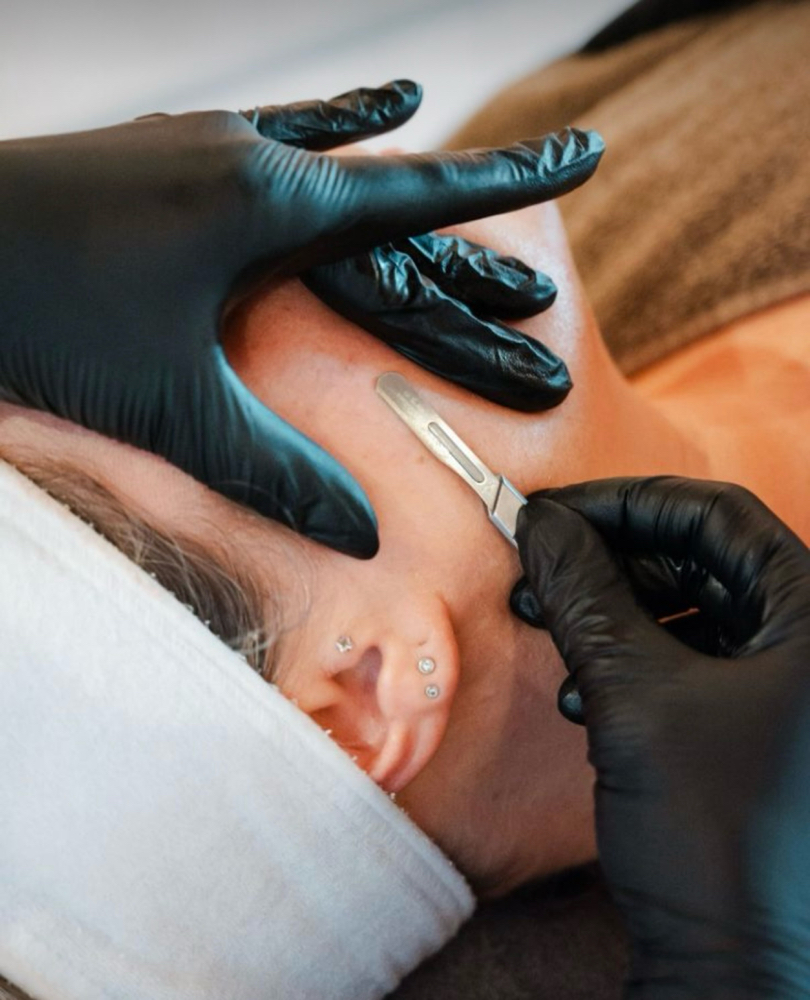 Dermaplane Treatment Add On