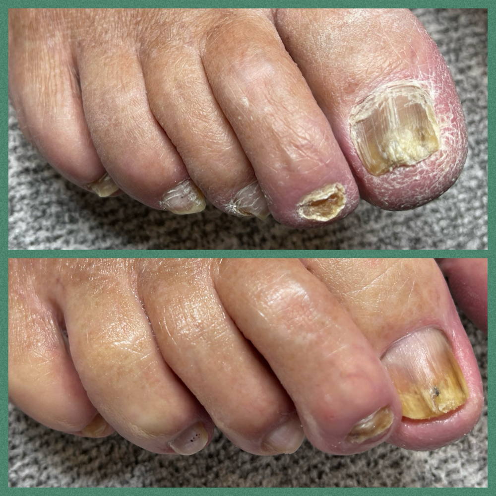 Restorative PEDICURE | Cosmetic Transformation