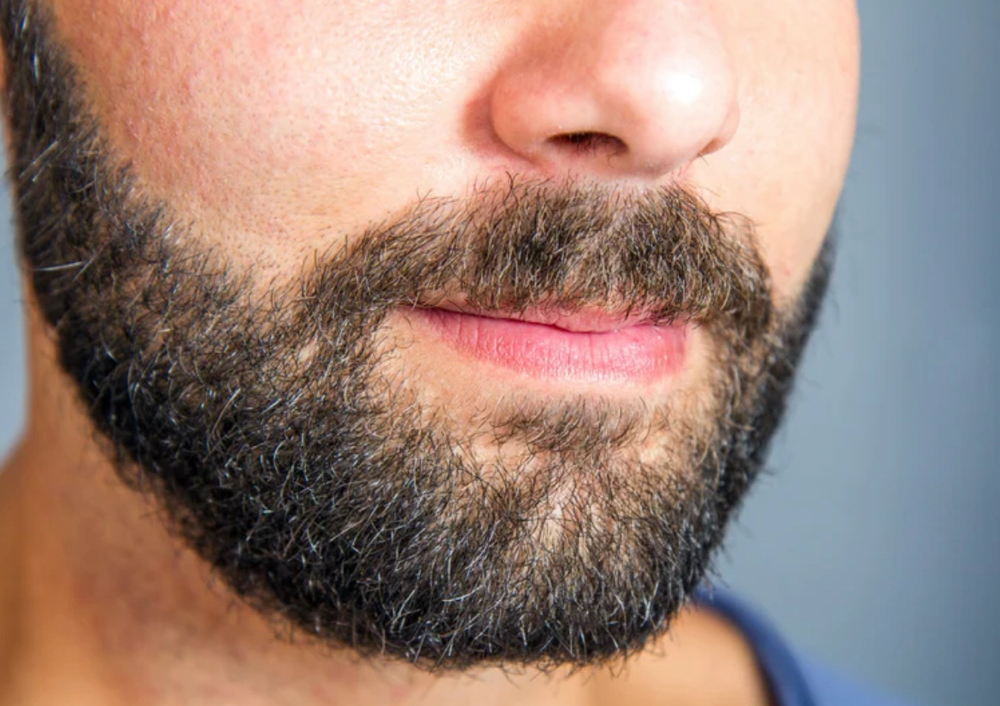 Beard/ Mustache
