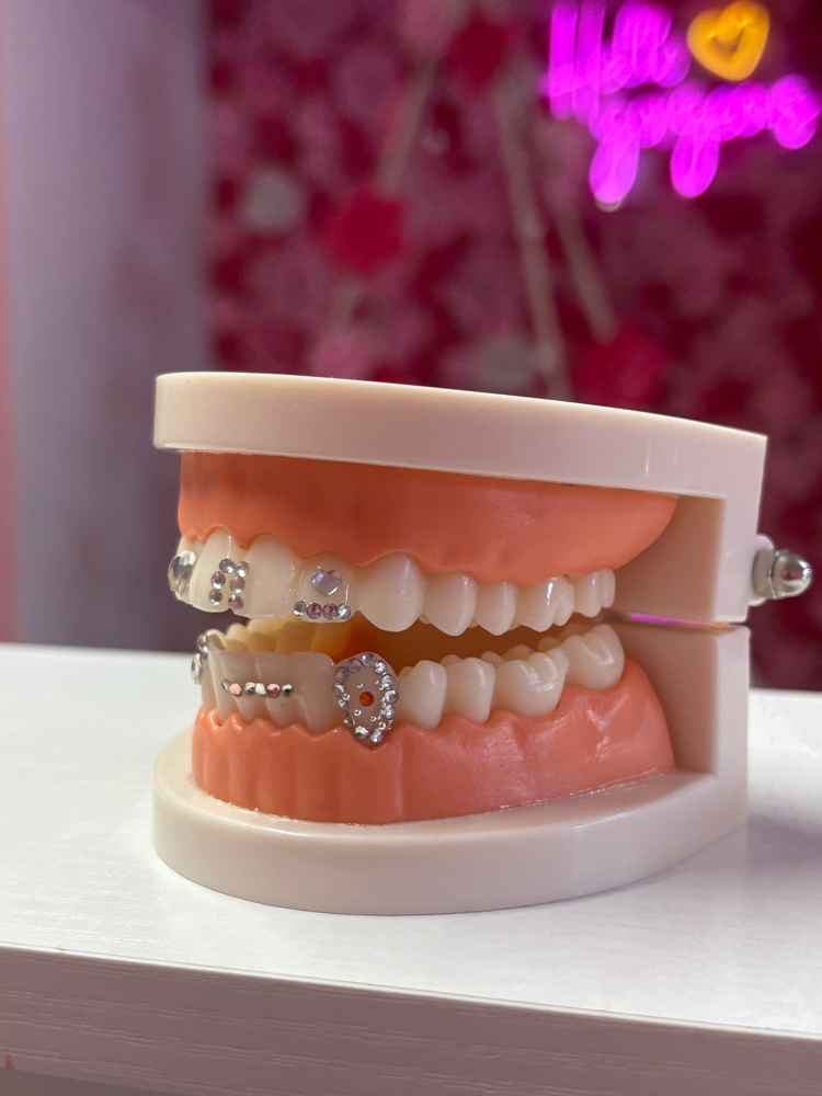 Tooth Gem (Rhinestone Crystals)