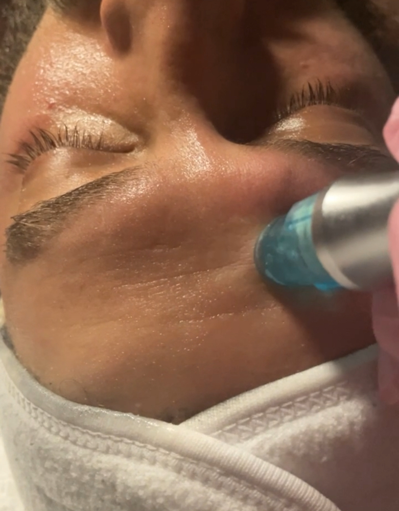 Zemits Hydroderm Facial