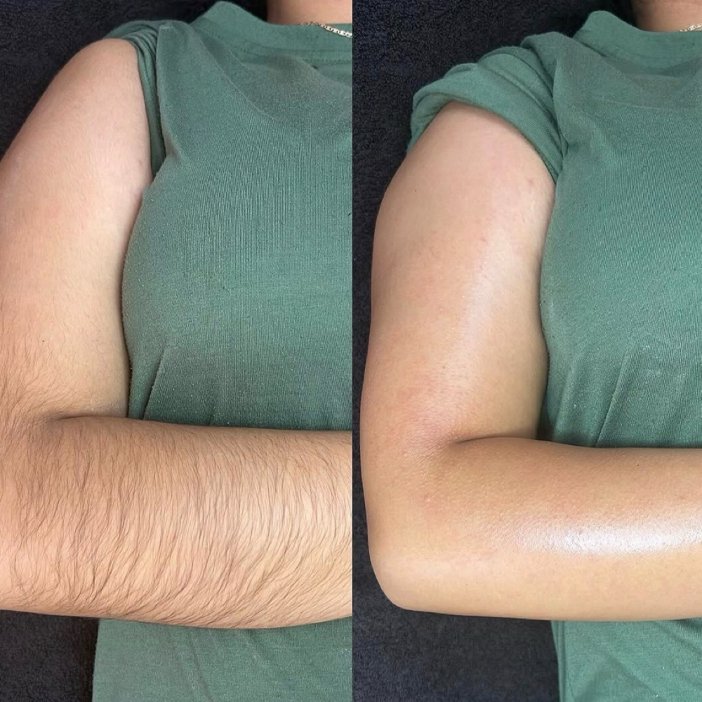 Full Arm Waxing Hair Removal at Amethyst Spa in Omaha, NE