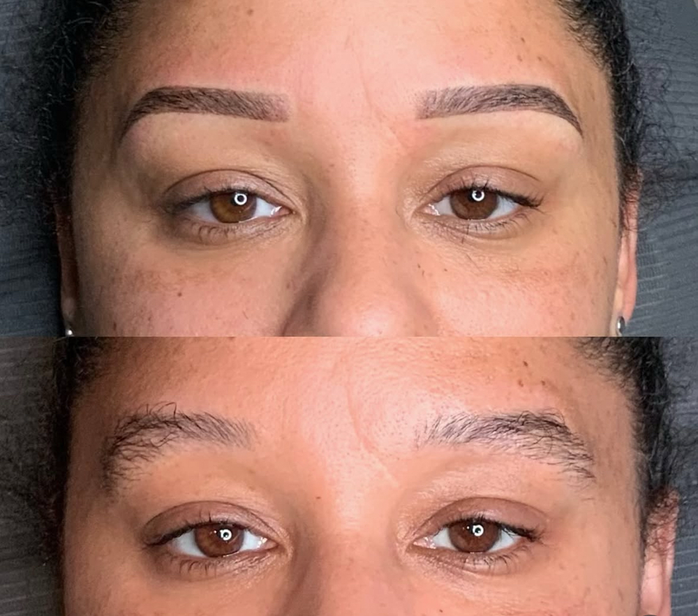 Consultation Microshading