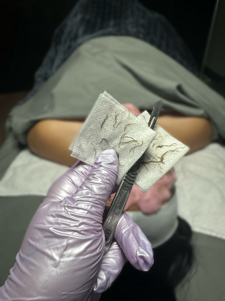 Dermaplane Only (no facial)