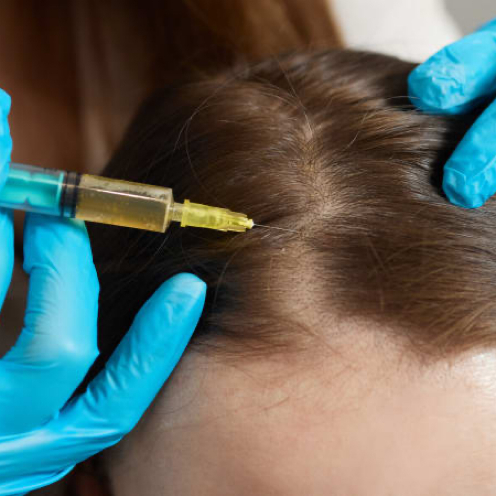 PRP Hair Treatment at EC Glam in Dearborn, MI