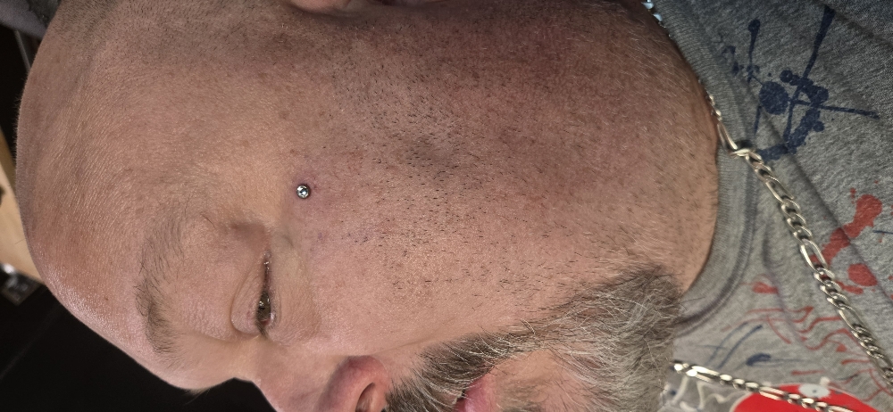 Dermal FACE