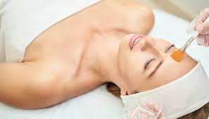 Chemical Peel